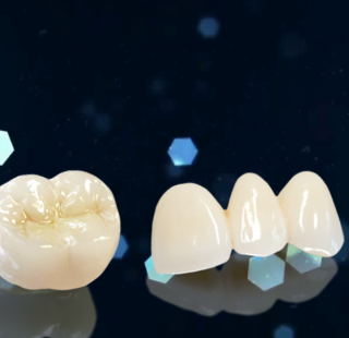 Phục Hình Răng sứ Emax