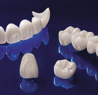 PHỤC HÌNH SỨ CERCON